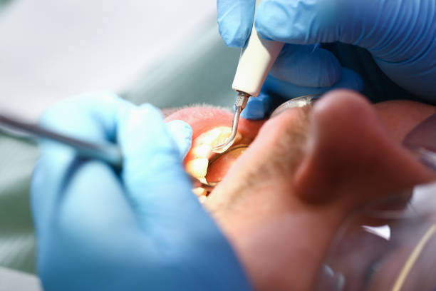 Best Emergency Wisdom Teeth Removal in Archbald, PA