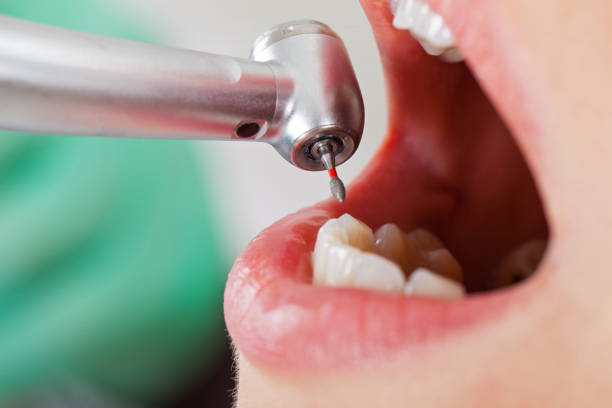 Best Emergency Treatment for Dental Infections or Abscesses in Archbald, PA